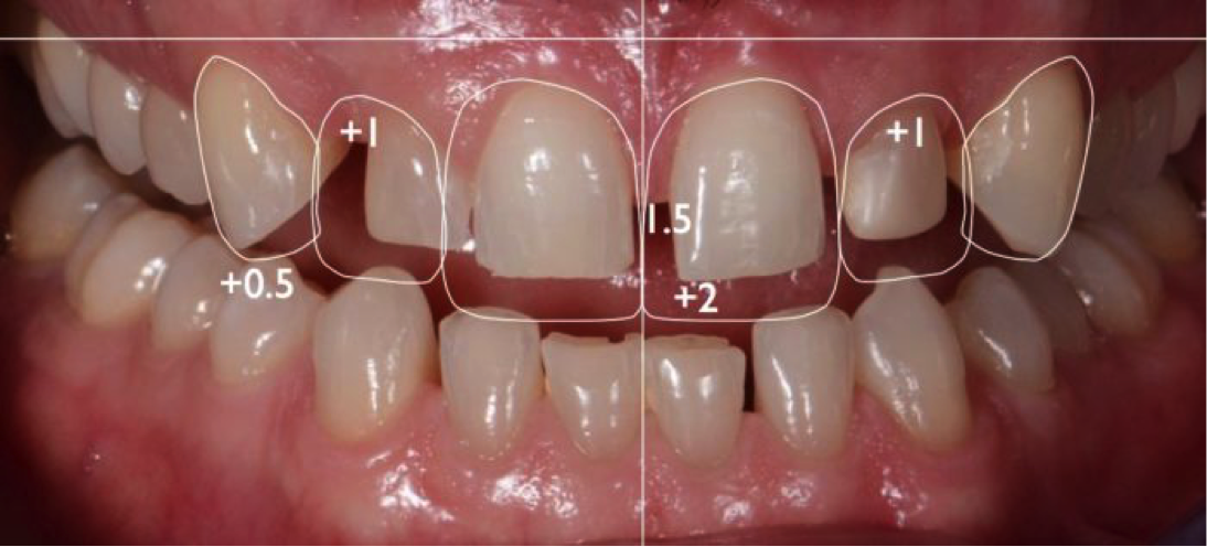 diseno-sonrisa